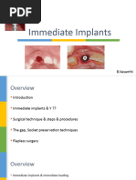 Immediate Implants