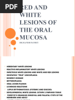 Red and White Lesions of Oral Mucosa