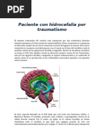 Paciente Con Hidrocefalia Por Traumatismo