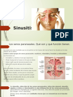 Sinusitis Aguda y Cronica