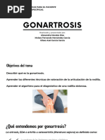 Gonartrosis