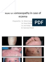 ECZEMA Seminar Presentation