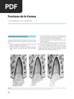 Fracturas Coronarias