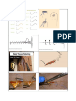 Suturing FFF
