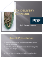 Breech Delivery Technique