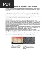 Fiber Post Techniques For Anatomical Root Variations