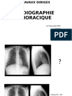 TD RX Thorax