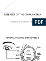 Conjunctivitis