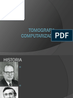 Tomografía Computarizada