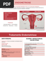 Lâmina ENDOMETRIOSE