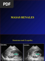 Masas - Renales - Imagen Diagnóstica