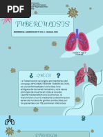 Tuberculosis