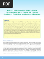 Class II Crowded Treatment