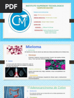 Mieloma y Adenocarcinoma de Colon. Bonilla