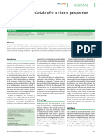 Genetics and Orofacial Clefts: A Clinical Perspective: General