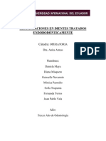 Restauraciones en Dientes Tratados Endododónticamente