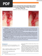 Clin Adv Periodontics - 2018 - Pilloni