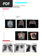 10-Pathologie Pleurale Et Extra Pleurale N.M