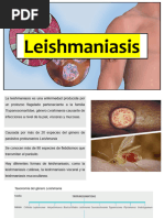 LEISHAMNIA