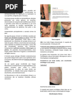 Dermatoses Fúngicas