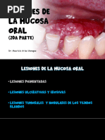 Lesiones de La Mucosa Oral 2