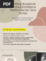 Atresia Duodenal