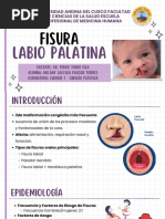 Fisura Labio Palatina