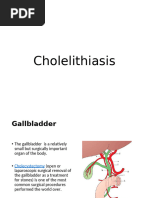 cholelithiasis