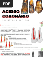 AULA 4 - ACESSO CORONÁRIO DE INCISIVOS E CANINOS