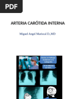 Arteria Carótida Interna