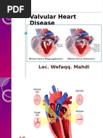 Valvular Heart Disease (1)