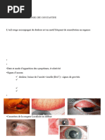 ophtalmo6an-oeil_rouge_douloureux2021mezaache