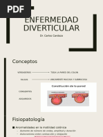 Diverticulitis