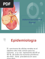 adenoma-renal (1)