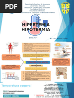 hipertermia