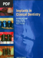 Implants in Clinical Dentistry 2002 - Palmer