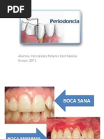 Parodoncia Terminada