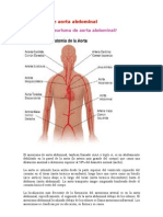 Aneurisma - Fracturas