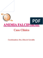 Anemia Falciforme