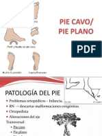 Pie Cavo-Pie Plano