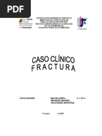 Caso Clinico Fractura