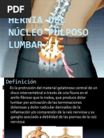 Hernia Del Núcleo Pulposo Lumbar - PPTX Yooo