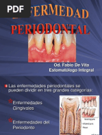 Enfermedad Periodontal FA