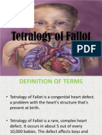 Tetralogy of Fallot