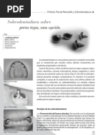 Sobredentaduras A Pernos Tapa o Ataches en Bola