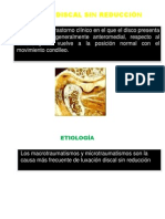 Luxación Discal Sin Reducción