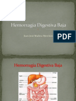 Hemorragia Digestiva Baja