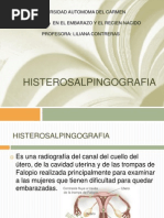 HISTEROSALPINGOGRAFIA