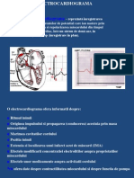 Ekg Normal