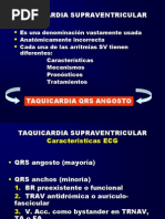 Taquicardia Supraventricular